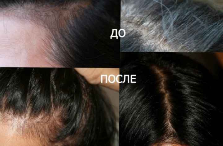 Фотоколлаж седых волос до и после окрашивания басмой в черный цвет